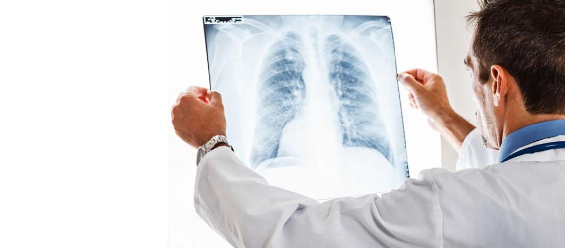 Krótkie terminy oczekiwania na chemioterapię! Prowadzimy wielokierunkową diagnostykę i leczenie wszystkich nowotworów płuc i innych nowotworów klatki piersiowej!